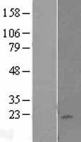 KLRC4 Human Over-expression Lysates NM_013431