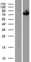 ACOX3 Human Over-expression Lysates NM_003501