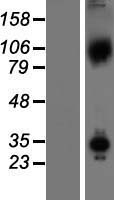Axin 1 (AXIN1) Human Over-expression Lysates NM_181050