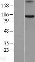 Axin 2 (AXIN2) Human Over-expression Lysates NM_004655