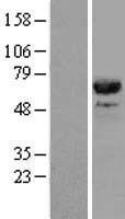 CDC45L (CDC45) Human Over-expression Lysates NM_003504