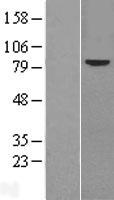 Frizzled 6 (FZD6) Human Over-expression Lysates NM_001164615