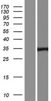 GFI1B Human Over-expression Lysates NM_001135031