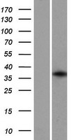 GFI1B Human Over-expression Lysates NM_004188