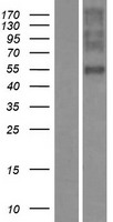 OR1E2 Human Over-expression Lysates NM_003554