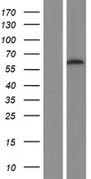 PIP5K1 alpha (PIP5K1A) Human Over-expression Lysates NM_001135636