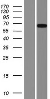 PIP5K1 alpha (PIP5K1A) Human Over-expression Lysates NM_003557