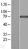 Calcium independent Phospholipase A2 (PLA2G6) Human Over-expression Lysates NM_001004426