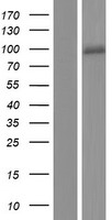 Calcium independent Phospholipase A2 (PLA2G6) Human Over-expression Lysates NM_003560