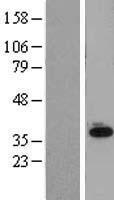 SLC25A11 Human Over-expression Lysates NM_003562