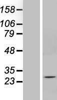 SOX14 Human Over-expression Lysates NM_004189