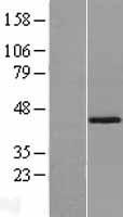 SPOP Human Over-expression Lysates NM_001007229