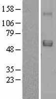 SRPX Human Over-expression Lysates NM_006307