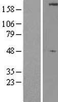 ls008408 ulk1 human over expression lysates nm 003565 wb testing 1