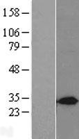Syntaxin 7 (STX7) Human Over-expression Lysates NM_003569