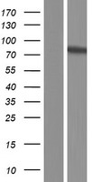 ZNF282 Human Over-expression Lysates NM_003575