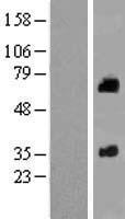 SOAT 2 (SOAT2) Human Over-expression Lysates NM_003578