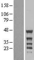 Nck beta (NCK2) Human Over-expression Lysates NM_001004720