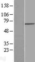 GNPAT Human Over-expression Lysates NM_014236