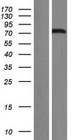 FOXN1 Human Over-expression Lysates NM_003593
