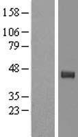 TPST2 Human Over-expression Lysates NM_001008566