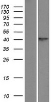 TPST1 Human Over-expression Lysates NM_003596