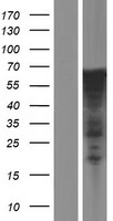 ls008462 fklf klf11 klf11 human over expression lysates nm 001177716 wb testing 1