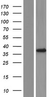 FKBP6 Human Over-expression Lysates NM_001135211