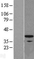 FKBP6 Human Over-expression Lysates NM_003602