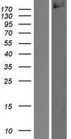 CDC42 binding protein kinase alpha (CDC42BPA) Human Over-expression Lysates NM_014826