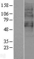 GPR65 Human Over-expression Lysates NM_003608