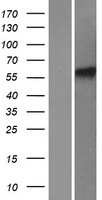HIRIP3 Human Over-expression Lysates NM_003609