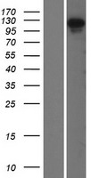 OFD1 Human Over-expression Lysates NM_003611