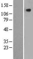 CILP Human Over-expression Lysates NM_003613