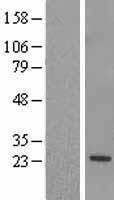 RGS5 Human Over-expression Lysates NM_003617