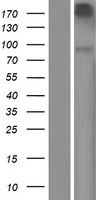 Neurotrypsin (PRSS12) Human Over-expression Lysates NM_003619
