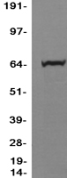 PPM1D Human Over-expression Lysates NM_003620