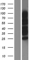 RANBP3 Human Over-expression Lysates NM_003624