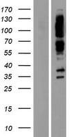 Liprin alpha 1 (PPFIA1) Human Over-expression Lysates NM_177423