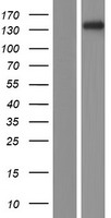 Plakophilin 4 (PKP4) Human Over-expression Lysates NM_003628