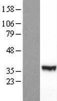 PI 3 Kinase p55 gamma (PIK3R3) Human Over-expression Lysates NM_001114172