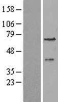 PEX3 Human Over-expression Lysates NM_003630