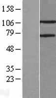 PARG Human Over-expression Lysates NM_003631
