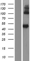 LIPF Human Over-expression Lysates NM_001198830
