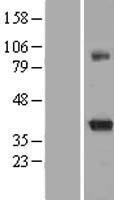 Kv beta 2 (KCNAB2) Human Over-expression Lysates NM_172130