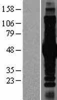 IKK gamma (IKBKG) Human Over-expression Lysates NM_001099857