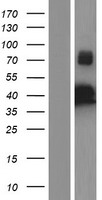 IKK gamma (IKBKG) Human Over-expression Lysates NM_001145255