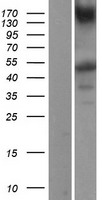 ls008517 ikk gamma ikbkg human over expression lysates nm 003639 wb testing 3