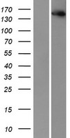 ls008518 ikap ikbkap human over expression lysates nm 003640 wb testing 1