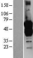 Growth Arrest Specific Protein 7 (GAS7) Human Over-expression Lysates NM_201432